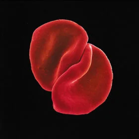 Peter Gabriel - Scratch My Back (Ed. Europe, 2010)